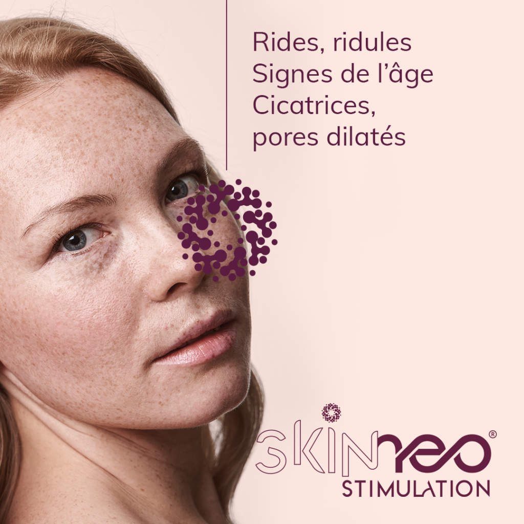 vignette_rs_2023_skineostimulation_version_08